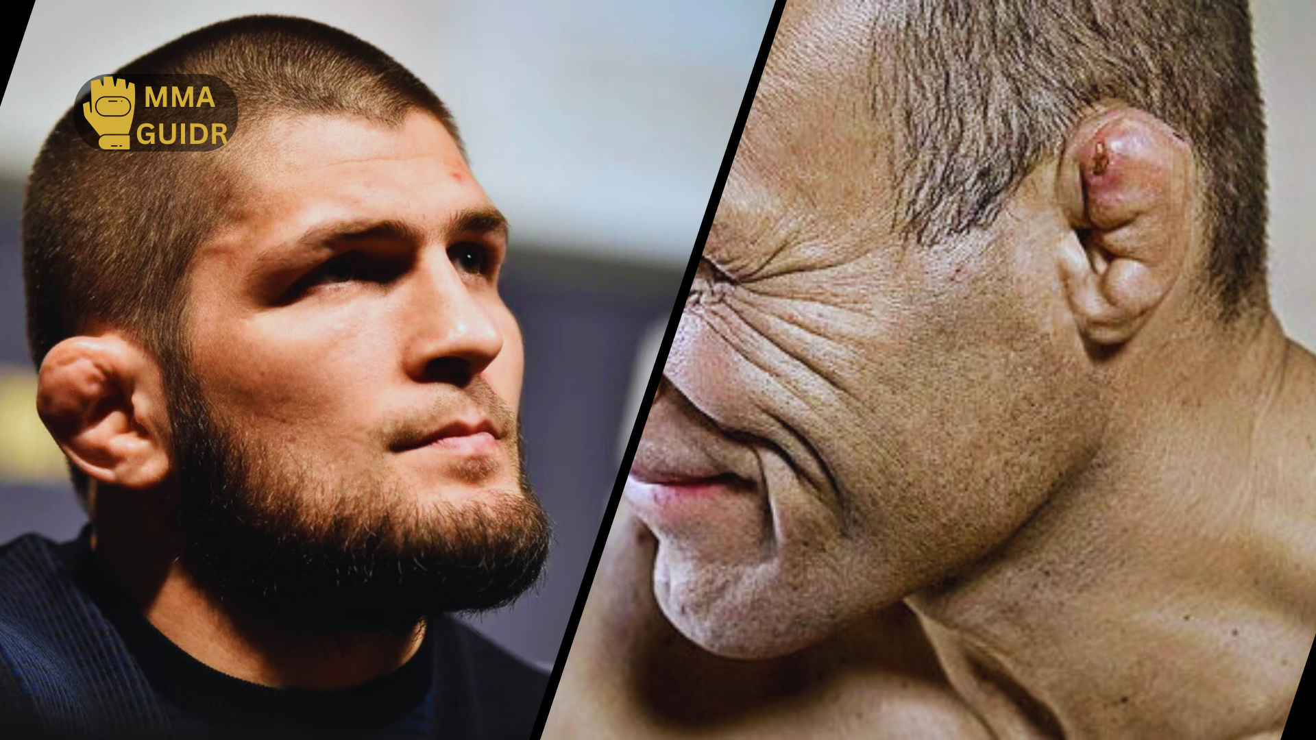 Is cauliflower ear a badge of honor or a medical risk? Discover the causes, prevention, and draining protocols for this common MMA injury. Read now!