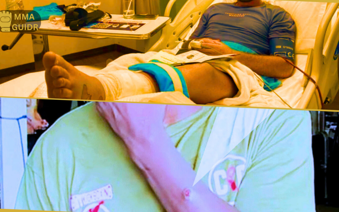 Staph Infection: The Gym Killer – Why Hygiene is the Real Heavyweight Champion