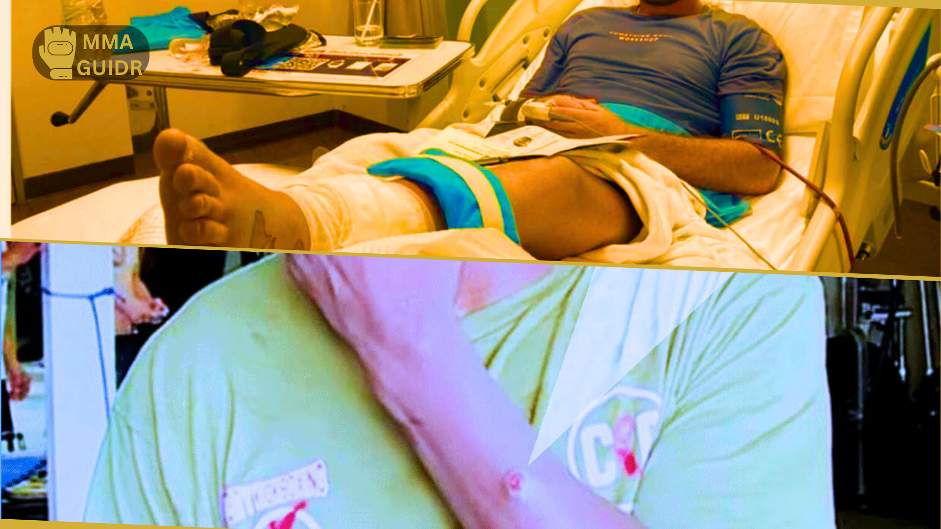 Staph infection is the silent killer of MMA fights. Learn the symptoms, famous cases like Randleman & Poirier, and essential gym hygiene tips to stay safe.